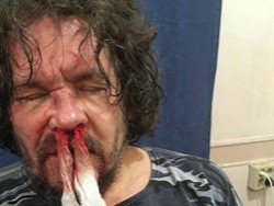 Избитый в Краснодарском крае эколог рассказал, за что на него совершили нападение